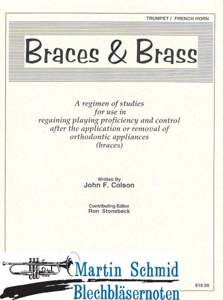 Artikelbild 1 des Artikels “Braces & Brass “